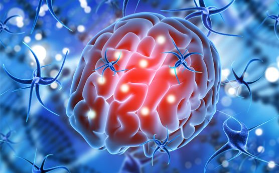 Multiple-sclerosis